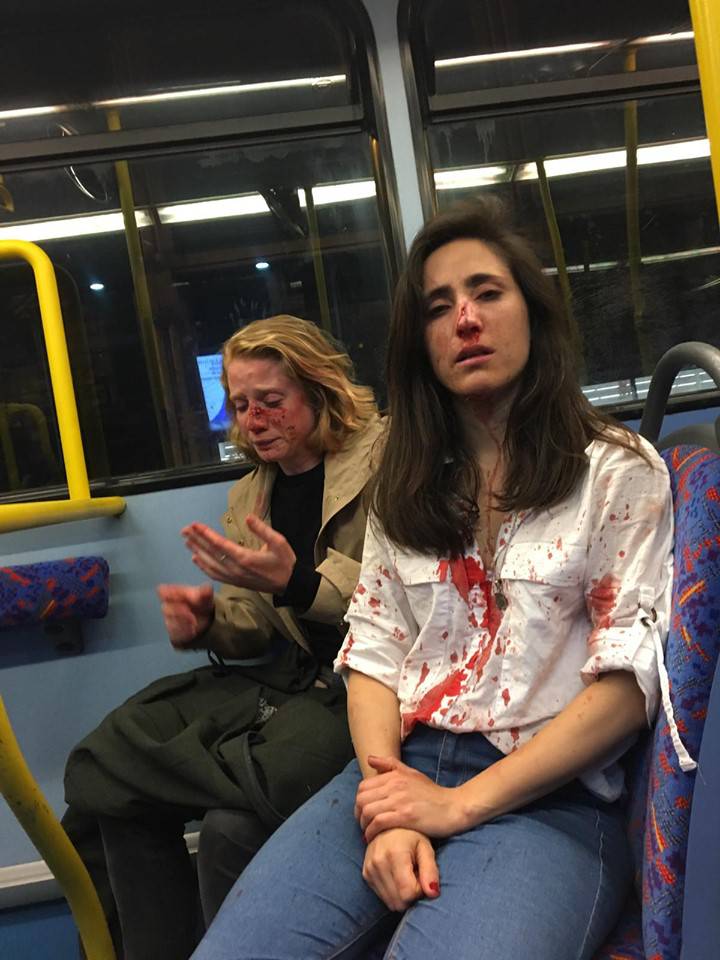 Homofobija u Londonu: Prebili dvije žene, a onda ih opljačkali