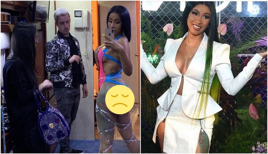Liposukcija Cardi B nije prošla dobro: Ma, nikada više pod nož!