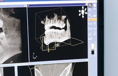Nova generacija stomatološkog liječenja za zdrav osmijeh