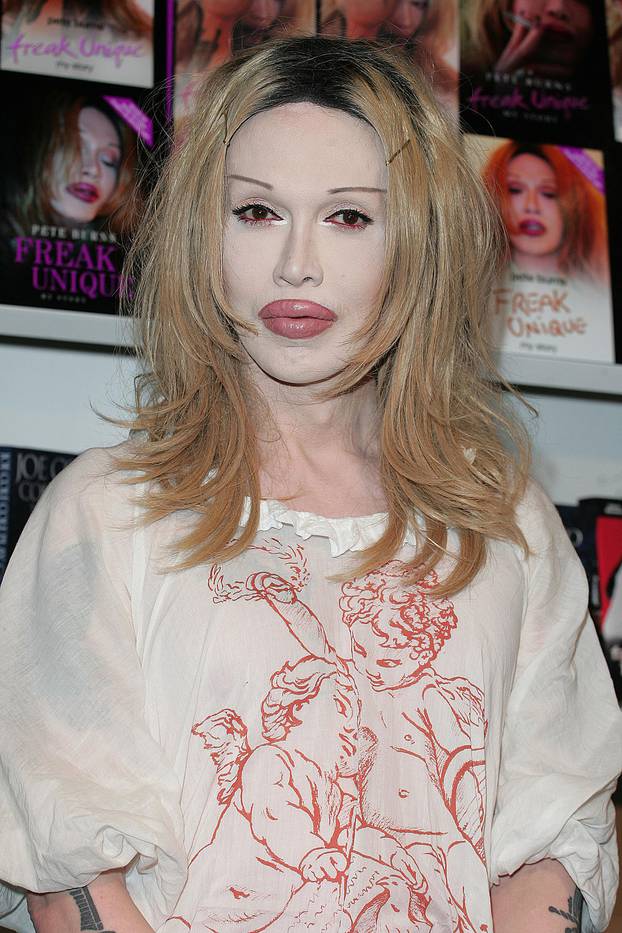 **PETE BURNS HAS DIES AT THE AGE OF 57 OF A REPORTED HEART ATTACK**