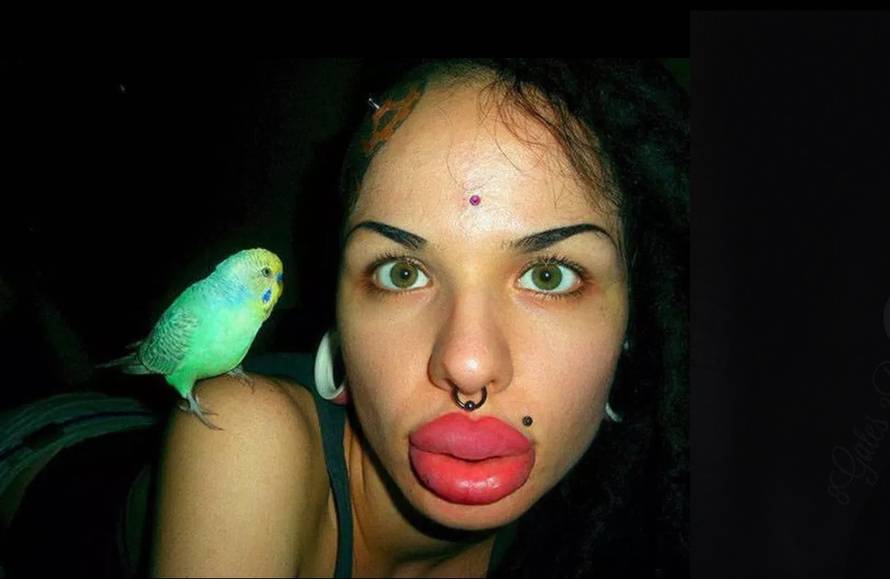 Pretjerale su s filerima: Zovu ih 'jeftinim porno glumicama'