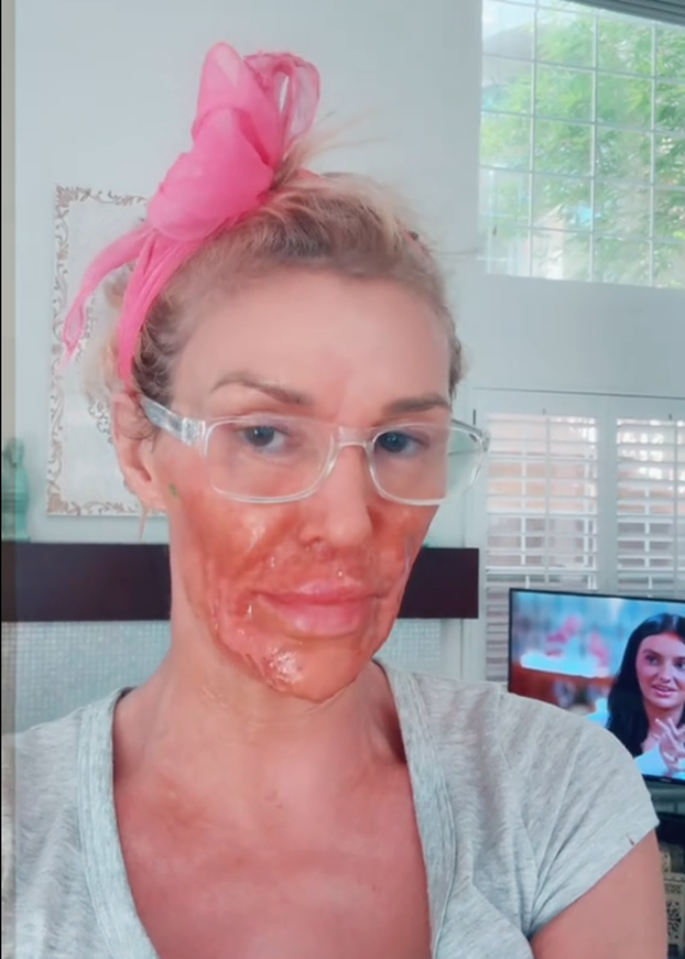 FOTO Ove slavne dame išle su pod nož: Neke su se 'popravile', druge su imale velikih problema