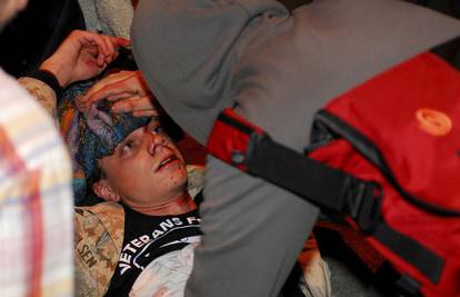 Policija prosvjednika pogodila suzavcem, u teškom je stanju 