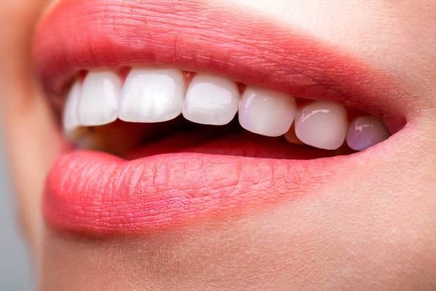 Beautiful,Young,Woman,Teeth.,Teeth,Whitening.,Dental,Health,Concept.,Teeth