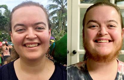 Australka pustila da joj izraste brada: 'Osjećam se slobodnije'