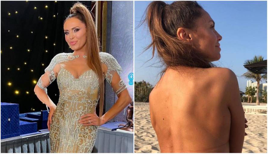 Emotivna Mila Horvat o teškim danima: 'Prije 10 godina život mi je ovisio o ovoj operaciji'