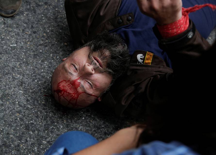 A man injured during clashes with Spanish police lies on the pavement outside a polling station for the banned independence referendum in Tarragona