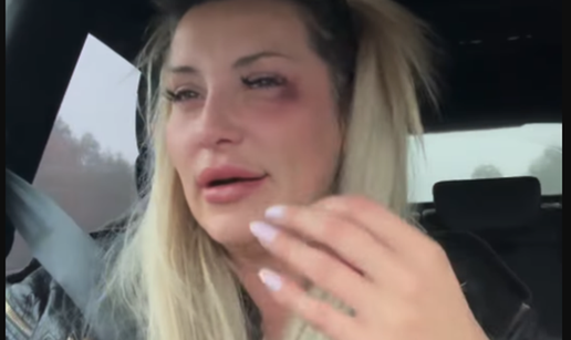 Pjeva&ccaron;ica Monika Ivki&cacute; u suzama i s masnicom na oku: 'Napala me je vlasnica kluba'