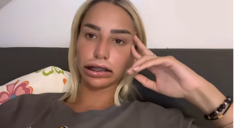 Srpska manekenka izvadila je silikone iz usana: Uništili su me