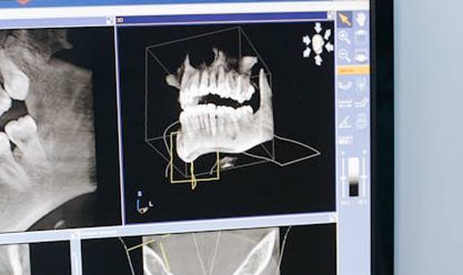 Nova generacija stomatološkog liječenja za zdrav osmijeh