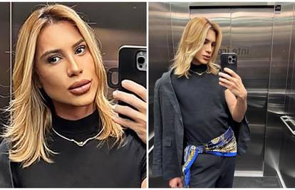 Preminuo poznati influencer: Htio je 'mačji' izgled, a tvrdio je da mu je oči operirao zubar