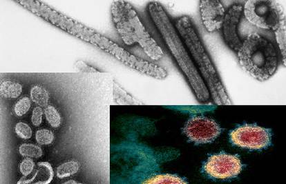 Top 12 najsmrtonosnijih virusa modernog doba - prijetnja su