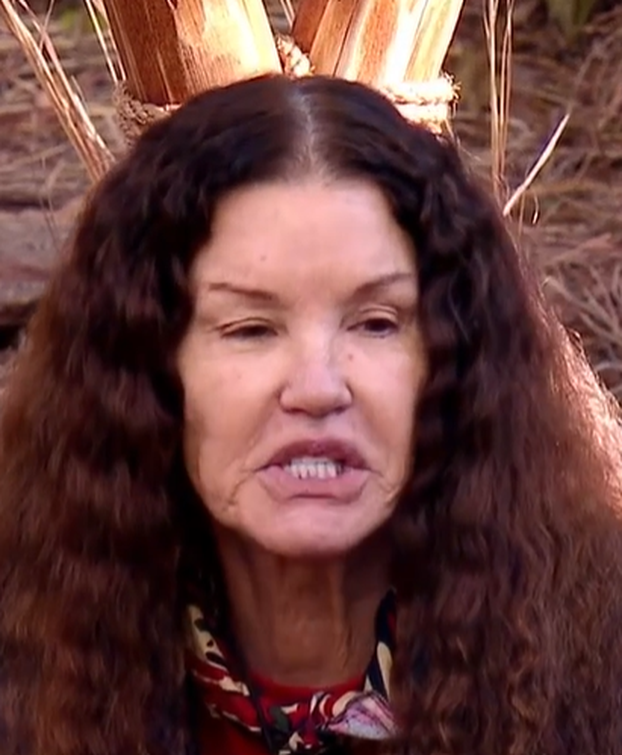 FOTO Bila je jedna od najljepših manekenki, a onda je pala u dugove zbog plastičnih zahvata