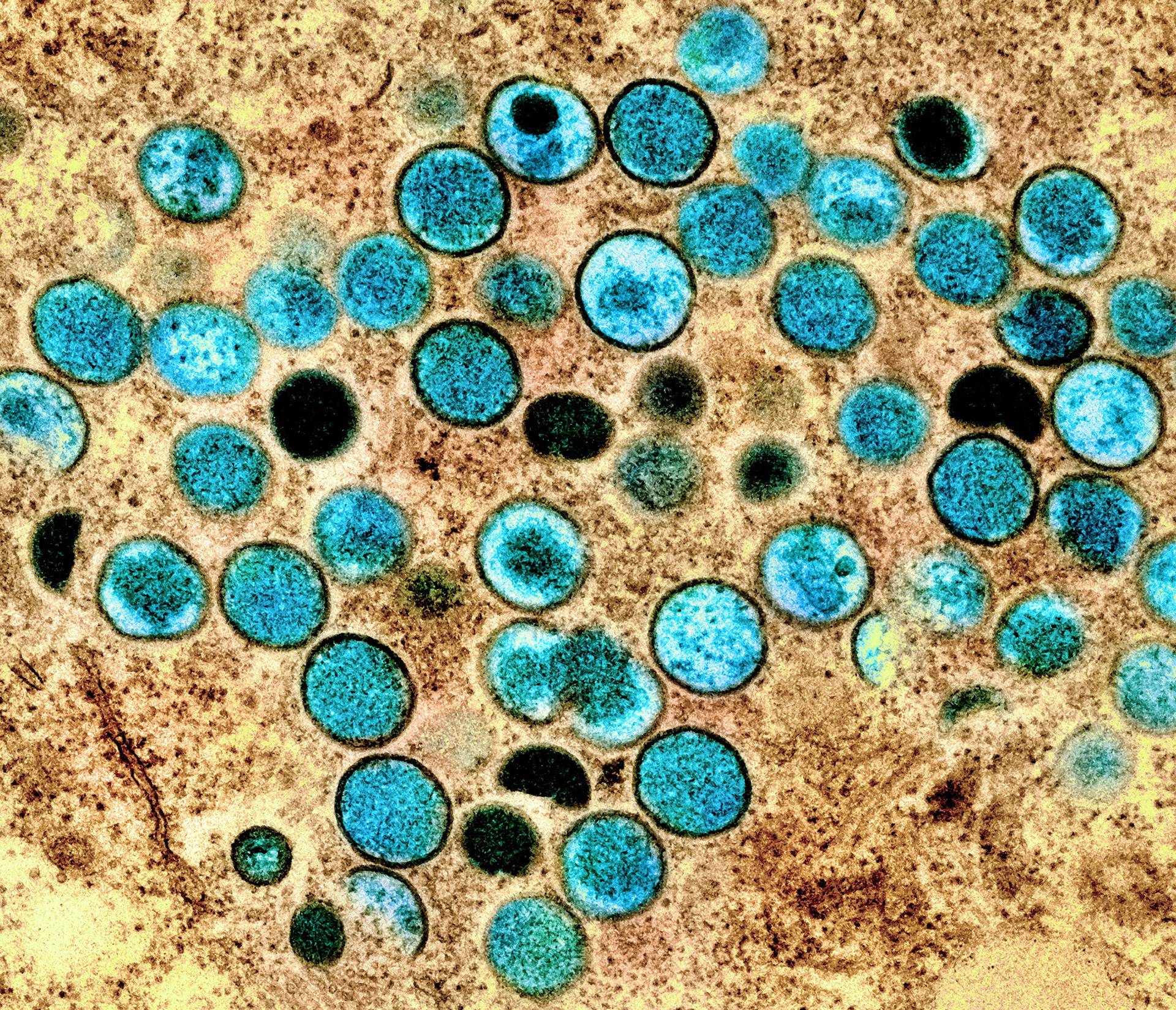 Colorized transmission electron micrograph of mpox virus particles captured at the NIAID Integrated Research Facility in Fort Detrick