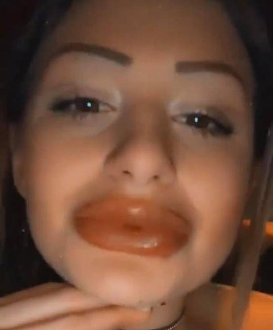 Tako mlade, a tako napumpane: Hana i Mandarine trče pod nož