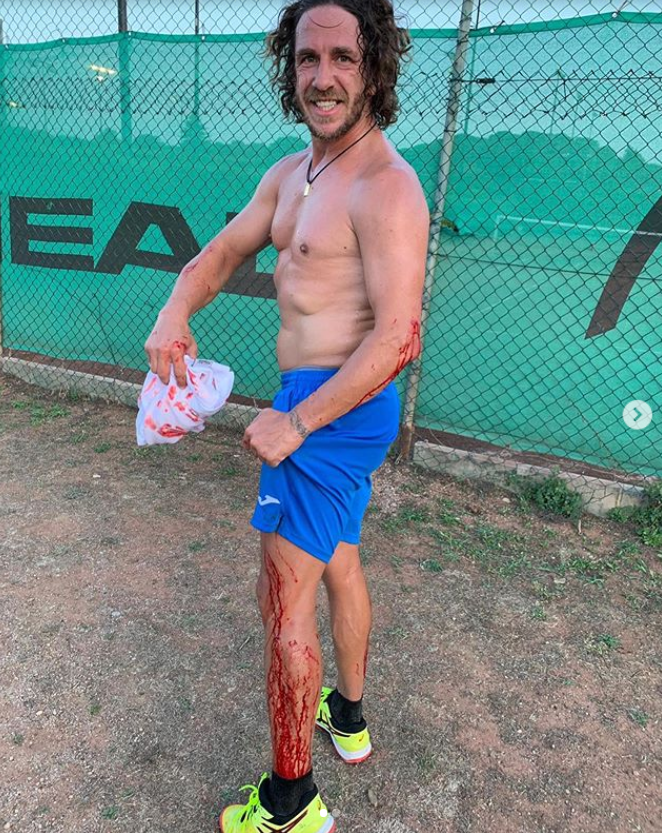 I kad igra tenis, krv do koljena: Ludi penzioner Carles Puyol...