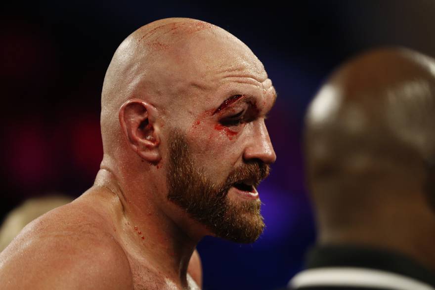 Tyson Fury