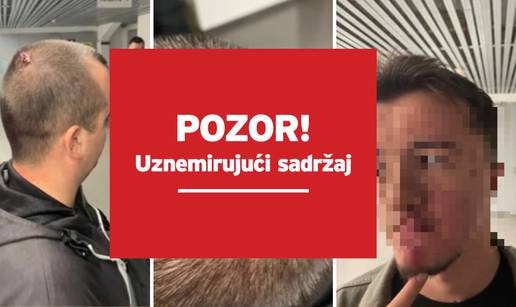 Srpska televizija objavila fotke pretučenih u Zadru. Policija je nastavila privoditi umiješane