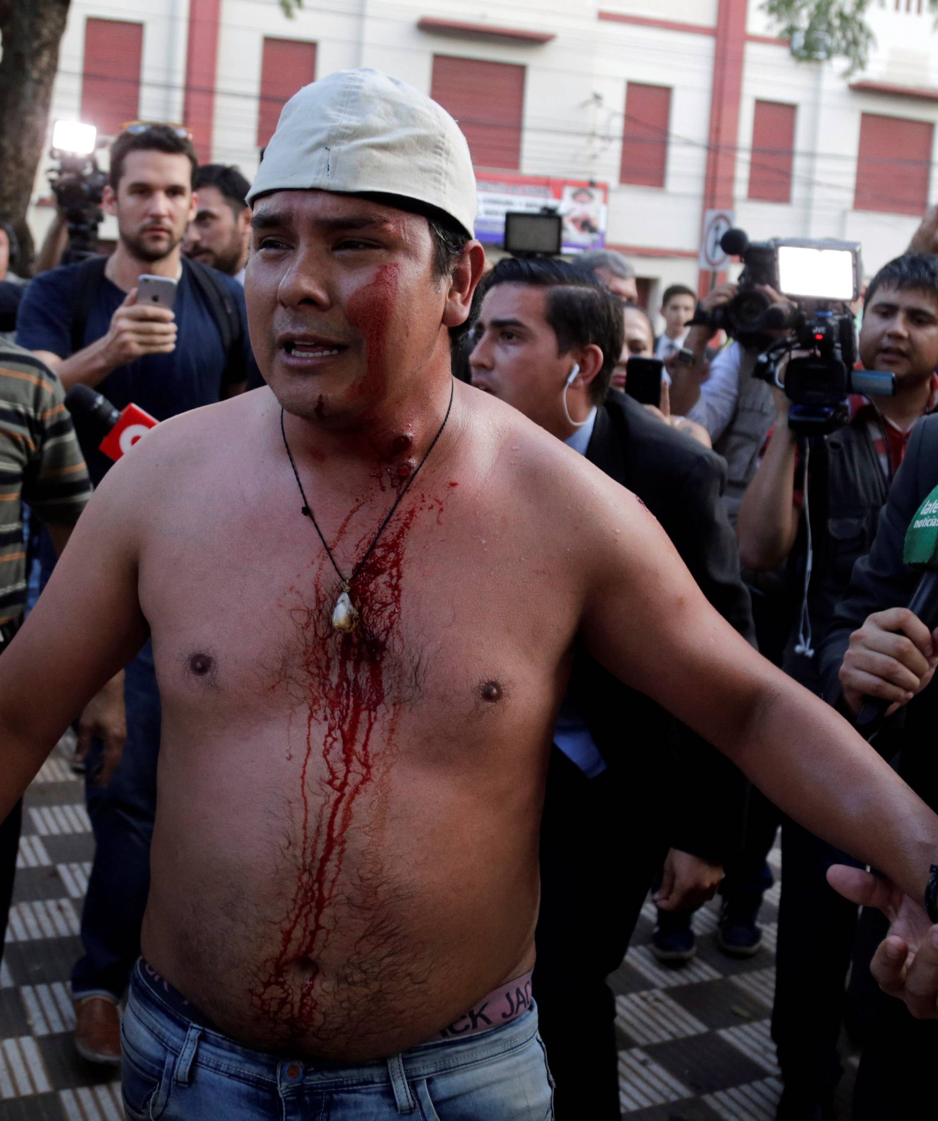 A protestor, who is wounded by a rubber bullet in clashes with police during a demonstration against a possible change in law to allow for presidential re-election, stands in front of the Congress building in Asuncion
