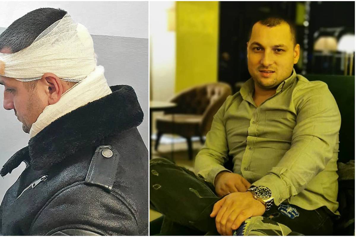 Ponovno skandal u regiji: Folk pjevača udarili bocom u glavu