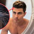 10 znakova manjka vitamina i minerala: Prosjeda kosa, umor
