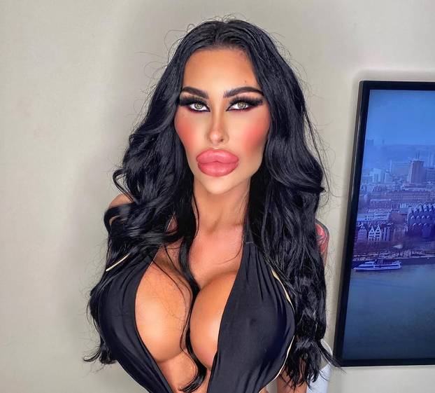 FOTO Potrošila više od 100 tisuća eura kako bi izgledala kao 'ljudska barbika' - Liječnici zgroženi