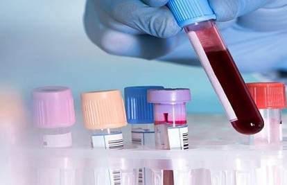 U Hrvatsku je stigao test za otkrivanje preko 160 vrsta raka iz jednog uzorka