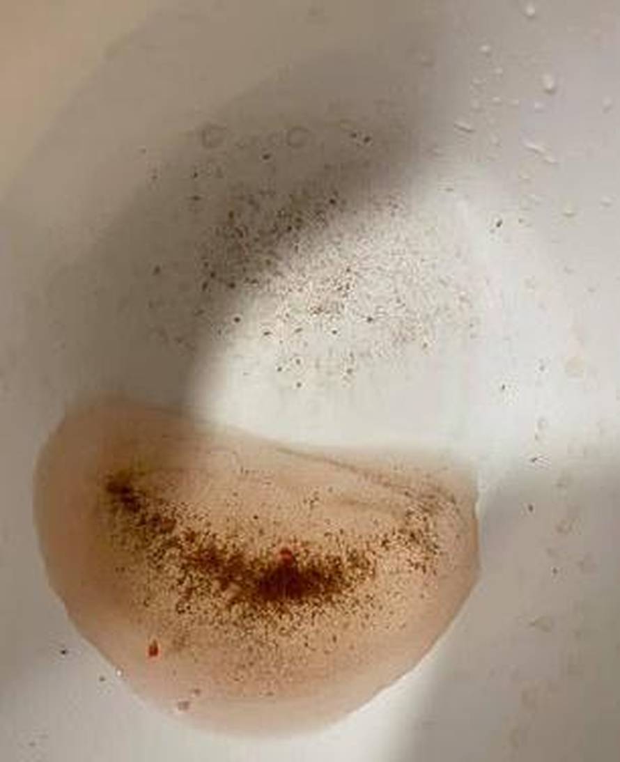 TikTokeri zgroženi: U jagodama pronalaze crve i male bubice