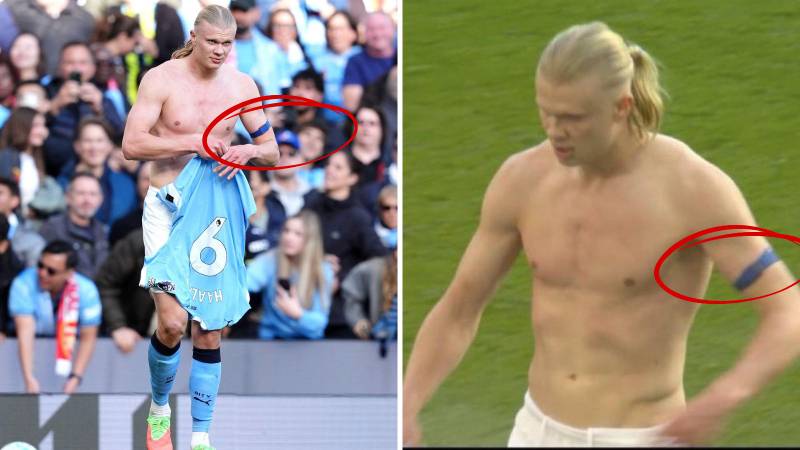 Što to Erling Haaland nosi na nadlaktici? Evo u čemu je stvar