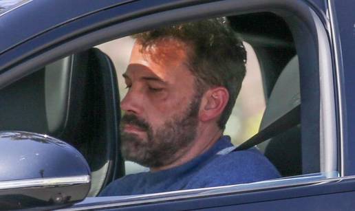 Ben Affleck nakon zahtjeva za razvod skinuo vjenčani prsten