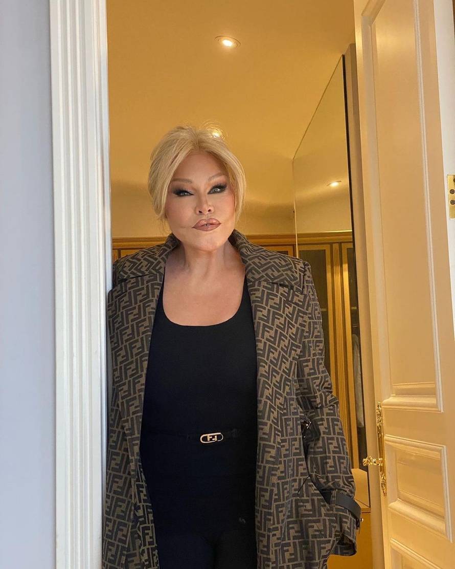Preminula 'žena mačka' Jocelyn Wildenstein (84). Milijarde je trošila na bezbrojne operacije