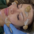Tretman lica puževima postao je popularan u Siriji: 'Bolji su nego kemikalije, a imamo ih 1500...'