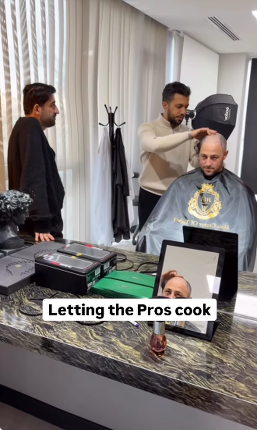 Trojčeki otputovali u Tursku na transplantaciju kose: 'Ne može samo jedan imati dobru frizuru'