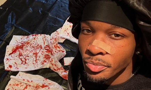 Šok u L.A.-u: U autu glazbenika pronašli raskomadano tijelo