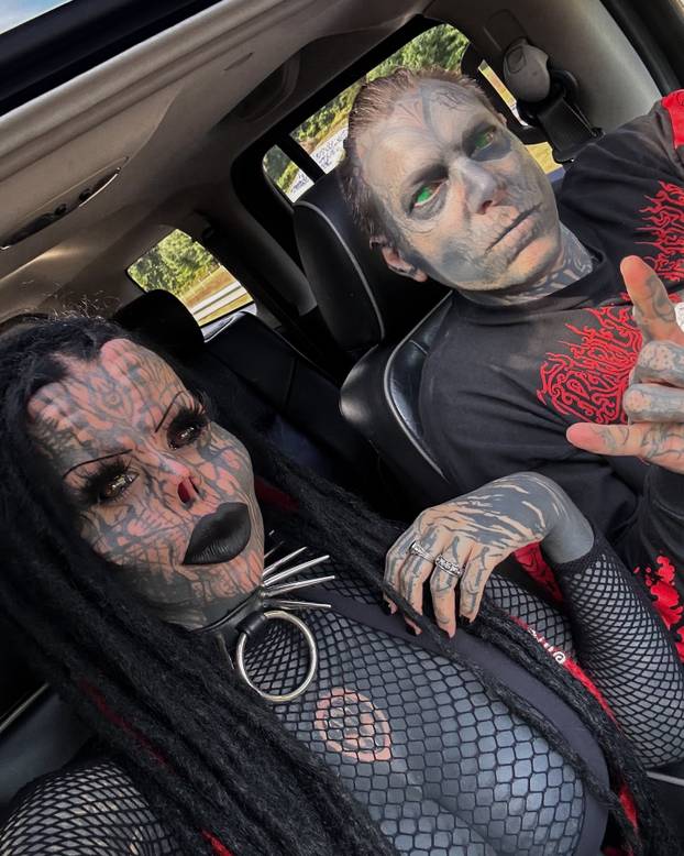 FOTO Uznemirujuće! Uklonila je čak i vrh nosa, a evo kako je izgledala: Šteta, ljepotica si bila