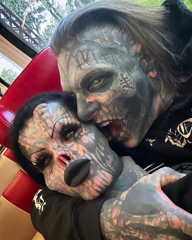 FOTO Uznemirujuće! Uklonila je čak i vrh nosa, a evo kako je izgledala: Šteta, ljepotica si bila