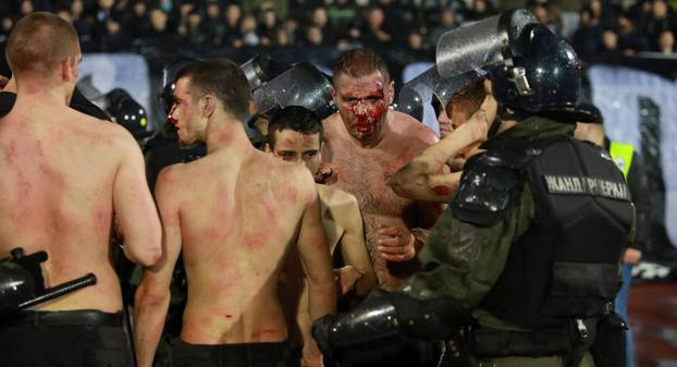 Police escort the soccer fans injured during the fights at a match between Red Star and Partizan in Belgrade