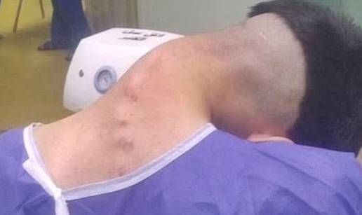 Mladić (23) pati od 'sindroma pale glave' - liječnici misle da je uzrok teška ovisnost o drogama
