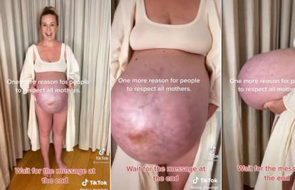 Trudnica je pokazala kako joj izgleda trbuh dok čeka trojčeke, pohvalio ju je i poznati doktor