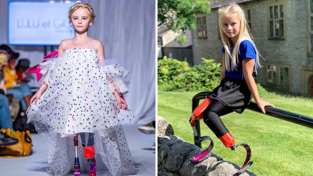 Djevojčicu bez nogu pozvali da nosi revije na Fashion Weeku