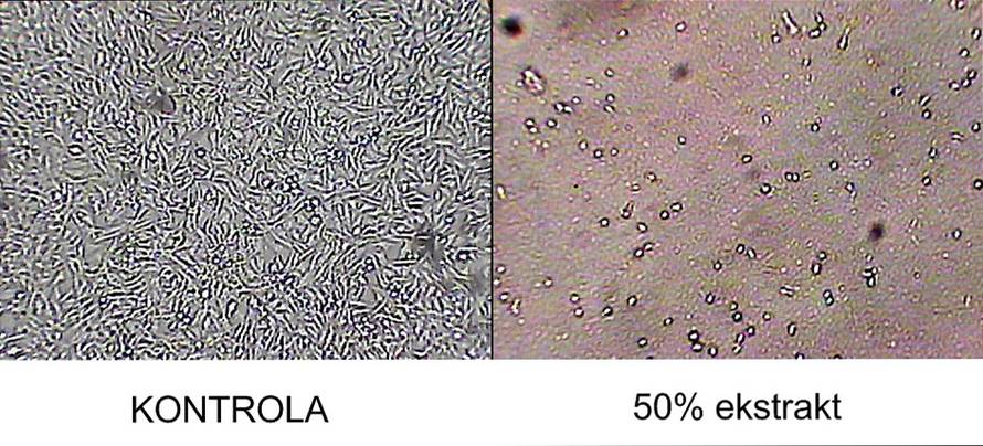 Nove mogućnosti protiv raka pluća