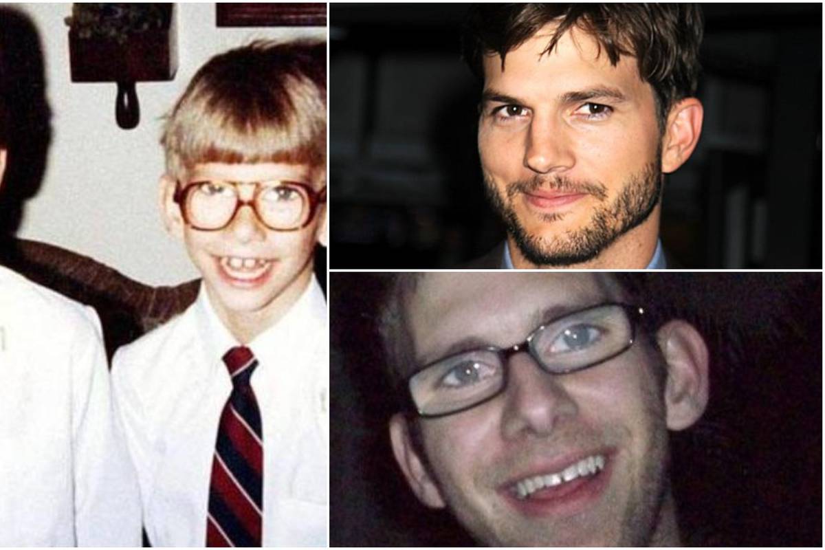 Brat blizanac Ashtona Kutchera: 'Bio sam jako ljut što je javno govorio o mojoj teškoj bolesti'