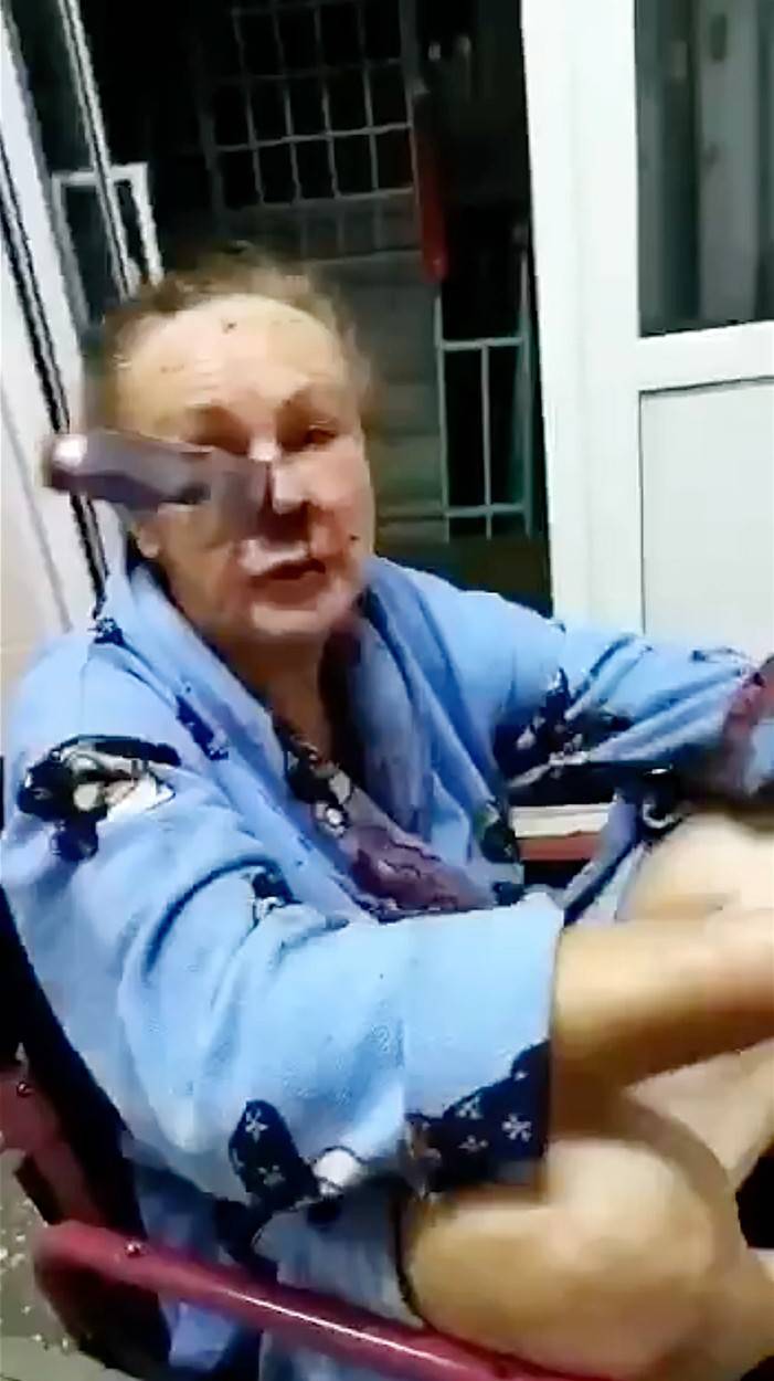 Knife stuck in nose