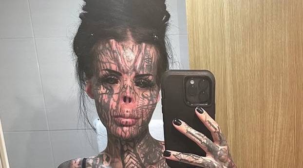 FOTO Uznemirujuće! Uklonila je čak i vrh nosa, a evo kako je izgledala: Šteta, ljepotica si bila