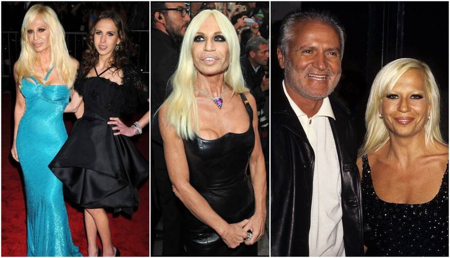 Donatella mrzi starenje, ovisna je o operacijama: Nisam rođena ljepotica. Prirodno je za povrće