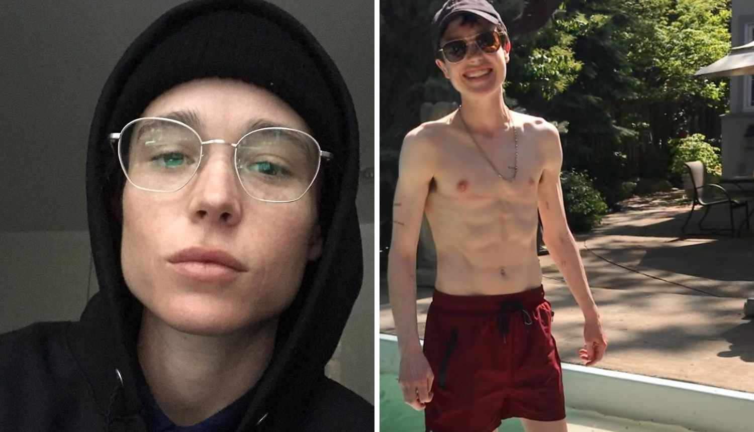 Transrodni glumac pozirao bez majice nakon operacije grudi: 'Ovo mi je promijenilo život'
