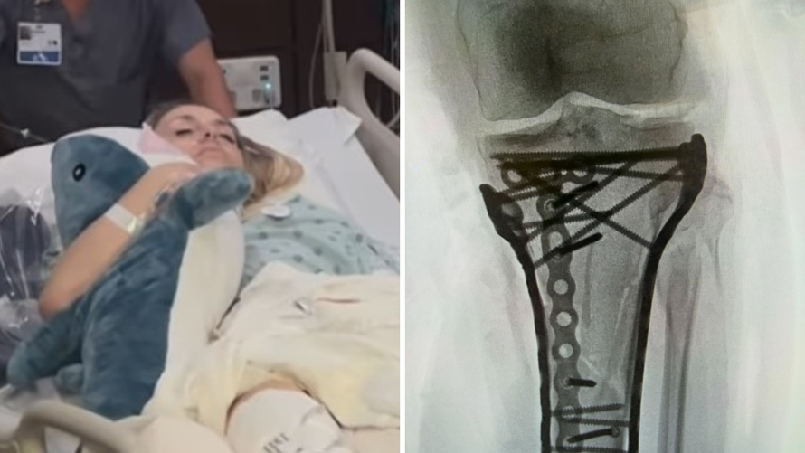 FOTO Lindsey Vonn vratila se kući, dočekao je bolan prizor: 'Bit će teško i bolno putovanje'