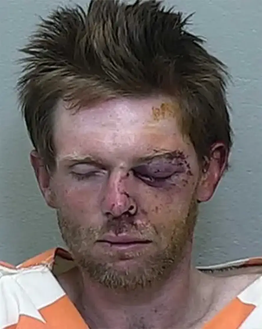 Čovjek sa sjekirom krenuo na MMA borca. Ovako je završilo