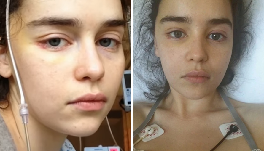 Emilia Clarke: Bila sam na rubu da ih molim da isključe aparate