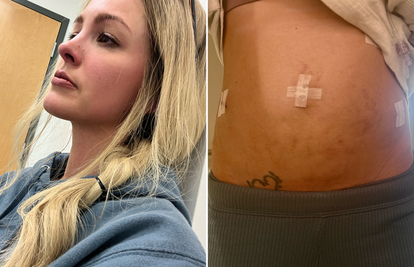 Nakon 12 godina boli, užasnih simptoma i uklonjene maternice dobila pravu dijagnozu